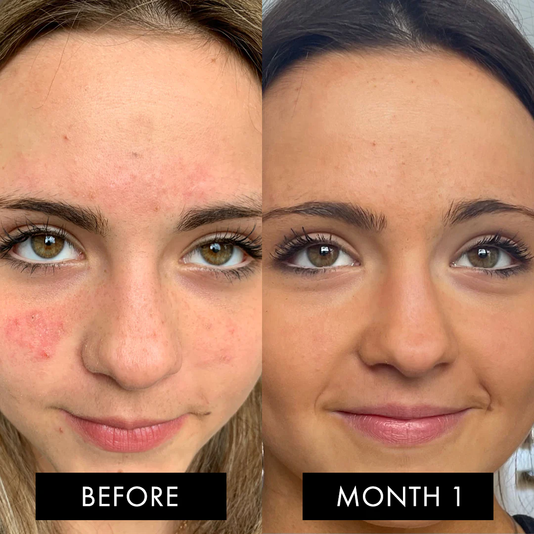 The Skin Elixir® - Image 10