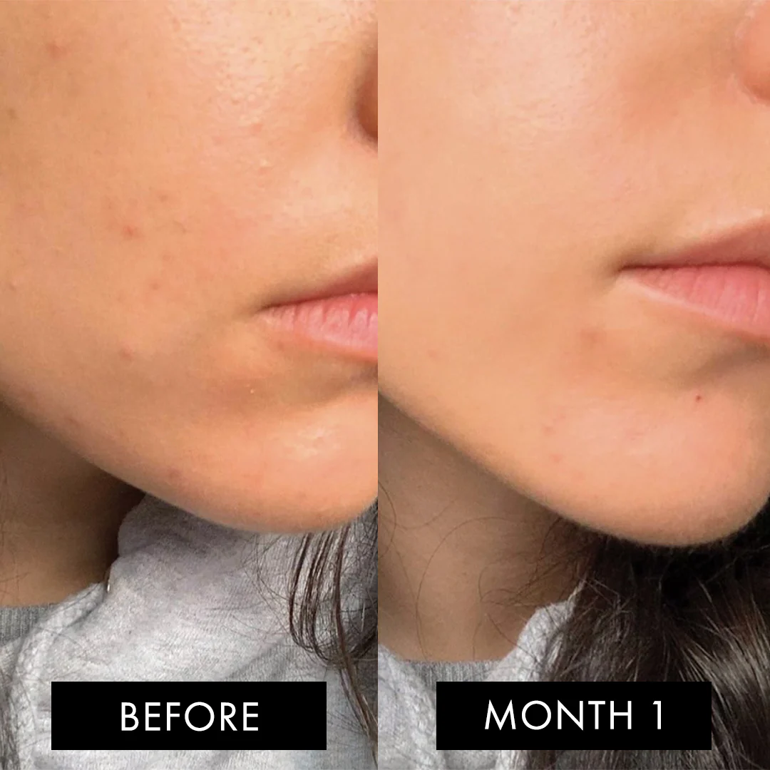The Skin Elixir® - Image 11