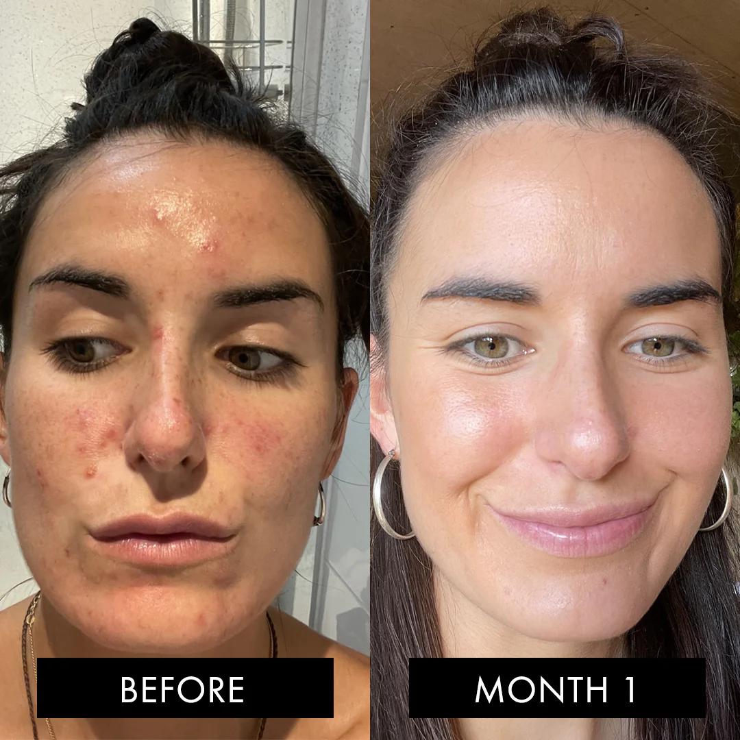 The Skin Elixir® - Image 7