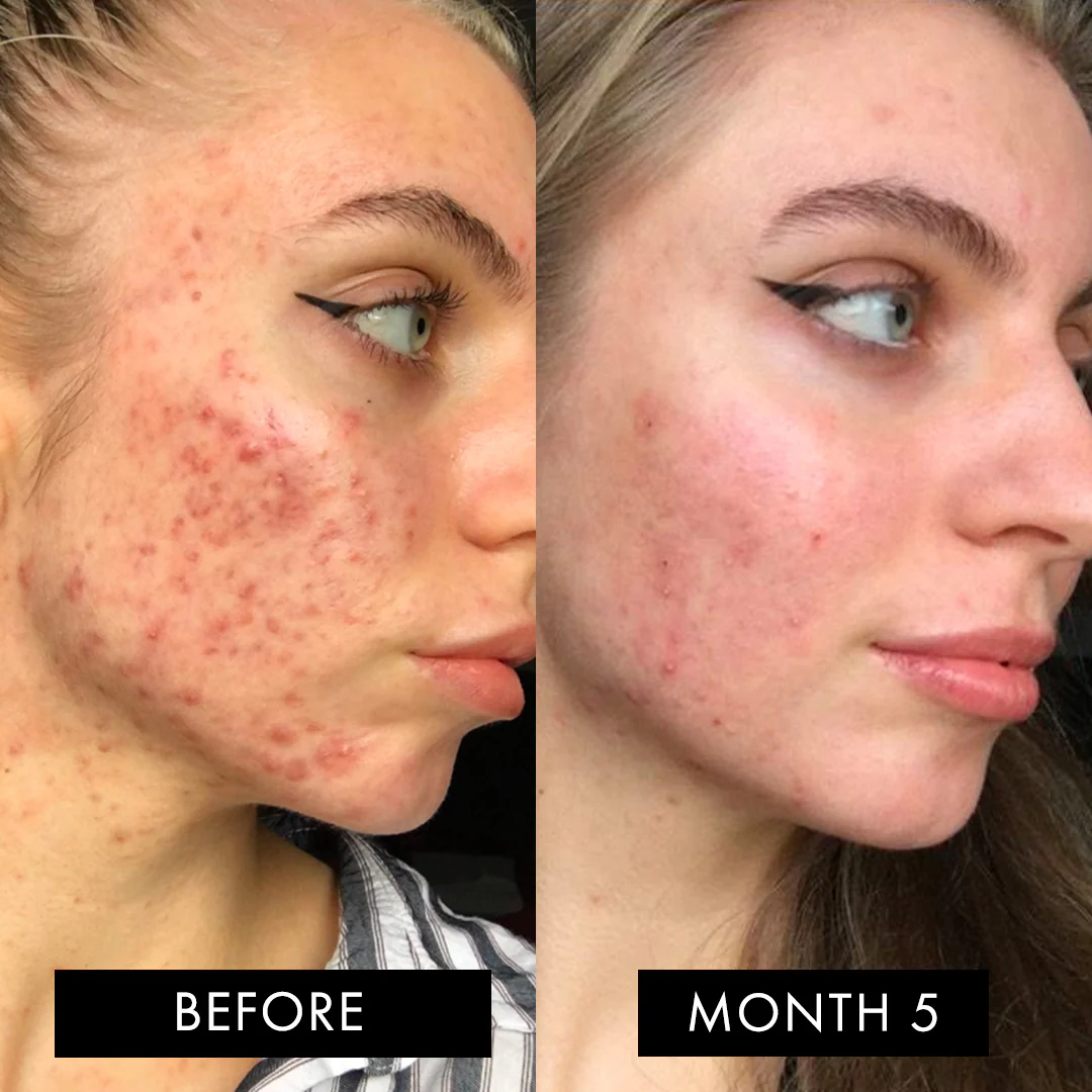 The Skin Elixir® - Image 8